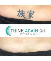 Think Again Laser Clinic - Auckland