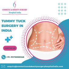 Tummy Tuck Surgery In India